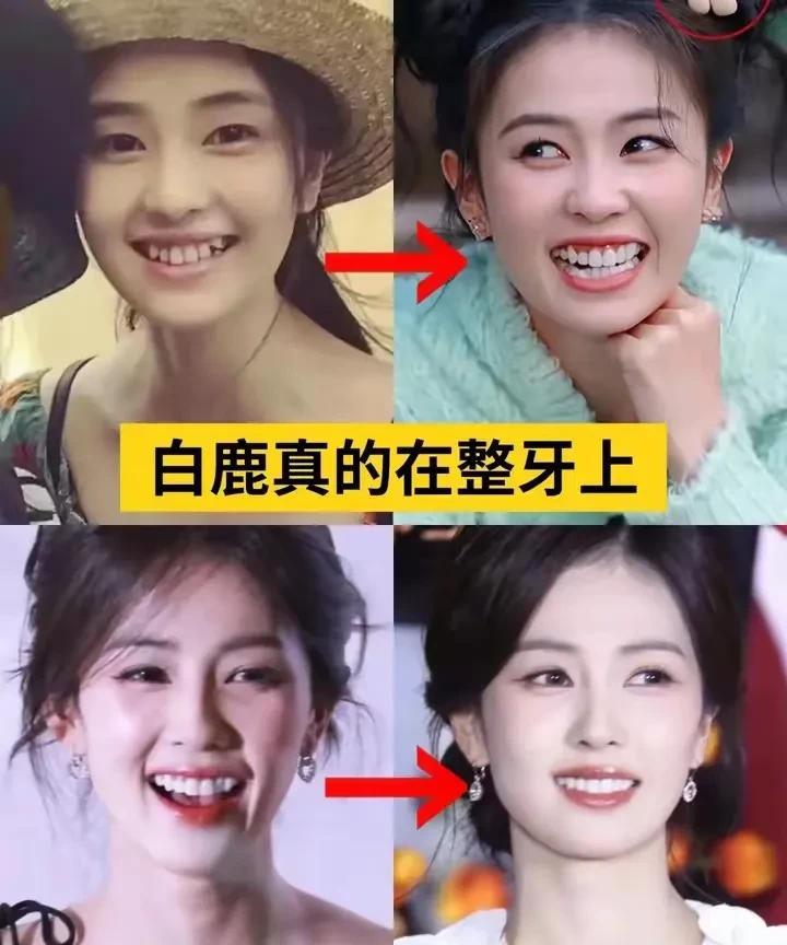 明星换牙惊天内幕