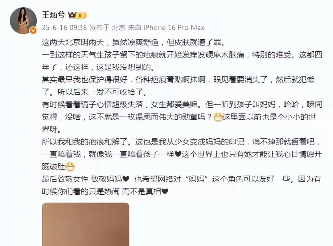 那道剖腹产疤痕是母爱的勋章！王灿晒产后真实疤痕自述心路历程